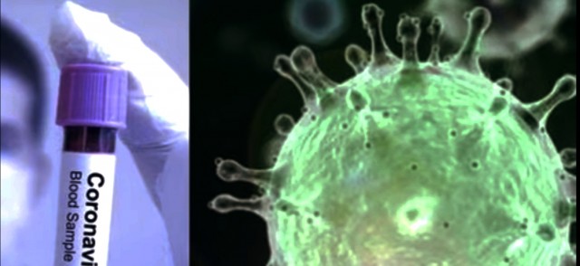 Pemkab Pali, Bupati Pali, Sekda Pali, Rapat Pemkab Pali